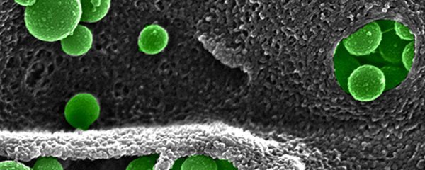 Nanoparticle Protein Interactions