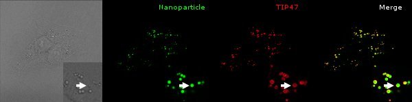 Elucidation of endocytosis , intracellular transport and release by microscopy